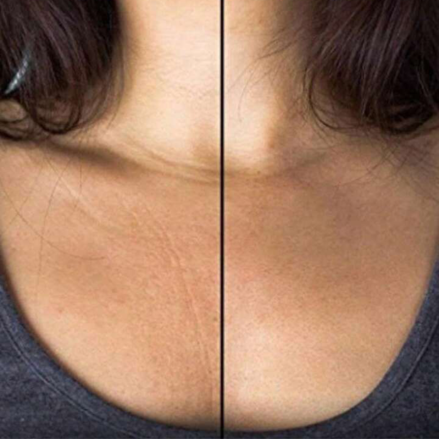 Silicone anti-ride 2